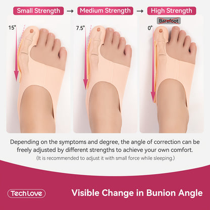 1Pair Corrector Socks, Big Toe Straightener for Day/Night, Adjustable & Breathable Sleeve In Shoe, Bunions Correction
