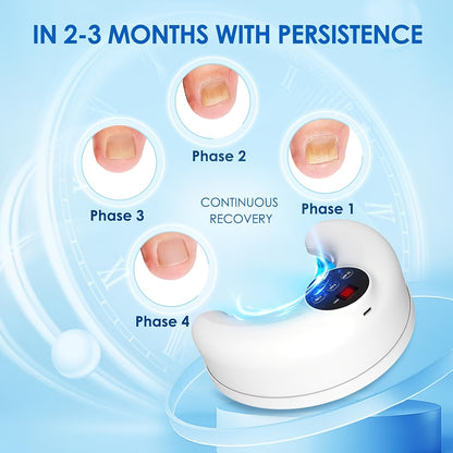 Nail Fungus Light Device FDA Cleared – KTS Toenail Fungus Treatment for Fingernails & Toenails, Repairs Damaged, Discolored & Thickened Nails, Portable At-Home Nail Fungus Laser Device