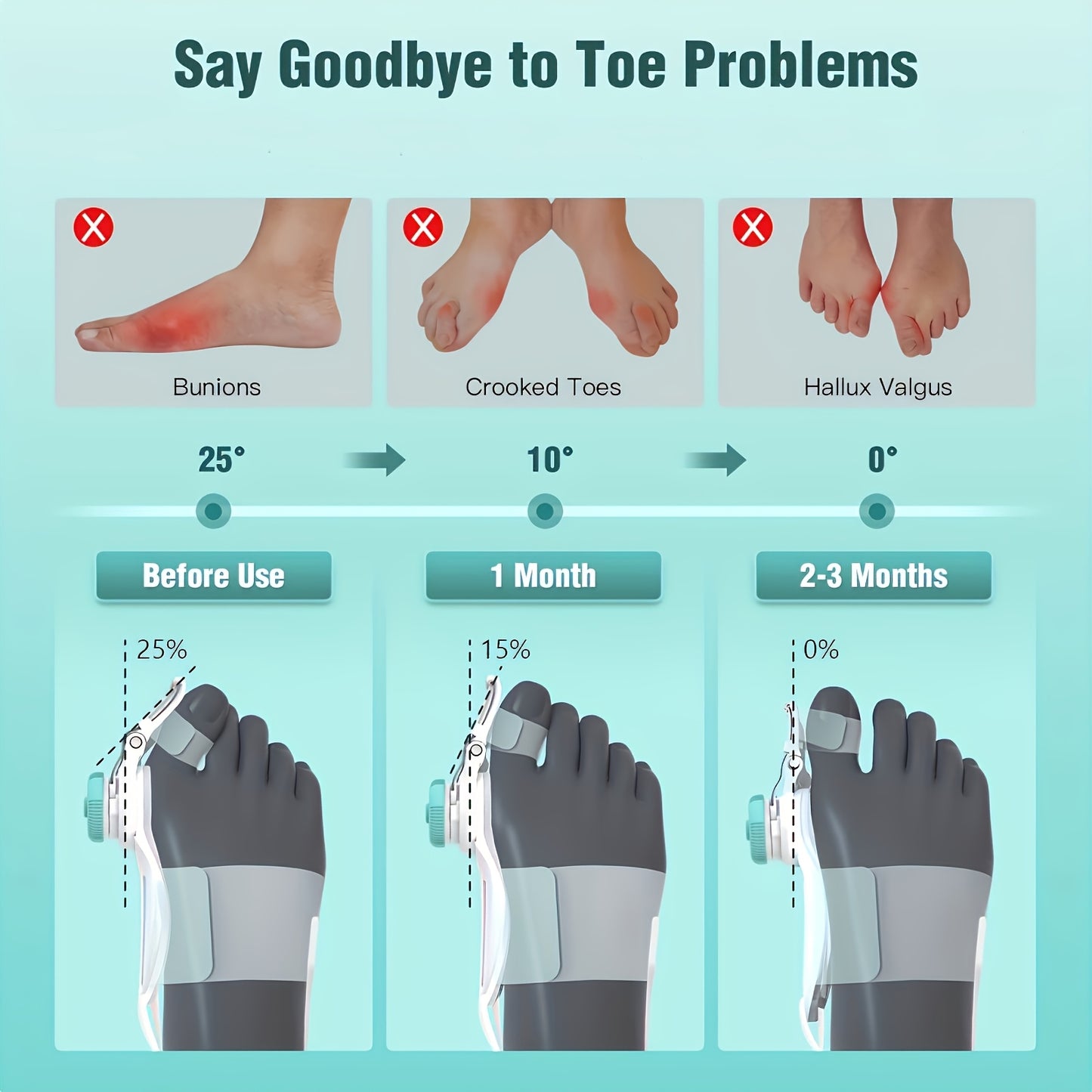 Device for Both Men And Women, Featuring an Adjustable Knob Splint for Bunions, Equipped with a Non-Slip Heel Strap, Compatible with Both Left And Right Feet