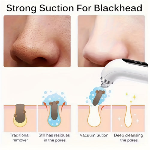 Pore Vacuum Blackhead Remover – 6 Interchangeable Heads & 3 Suction Levels, USB Rechargeable Electric Pore Cleaner, Visible Deep Cleansing Facial Extractor for Men & Women, All Skin Types