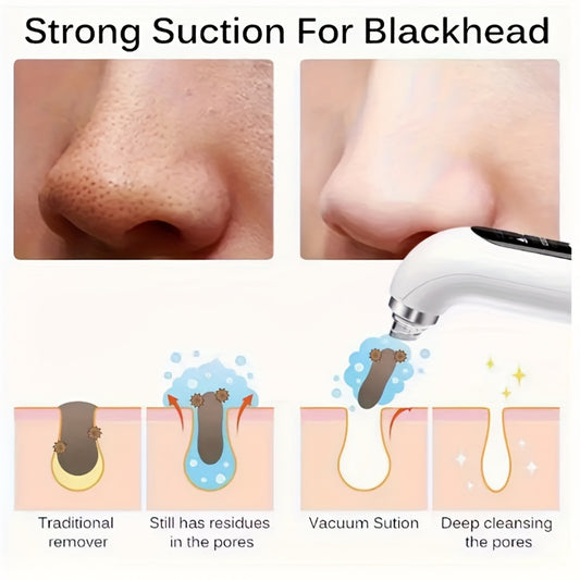 Pore Vacuum Blackhead Remover – 6 Interchangeable Heads & 3 Suction Levels, USB Rechargeable Electric Pore Cleaner, Visible Deep Cleansing Facial Extractor for Men & Women, All Skin Types