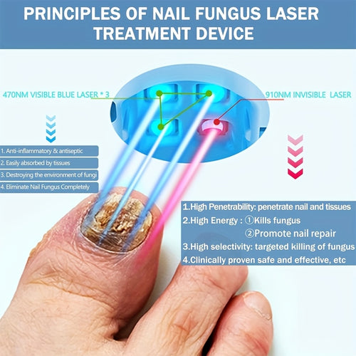 KTS FDA Cleared - for Nail Fungus Laser Cleaning Device for Toenail, Fingernail Fungus Treatment Extra Strength with 407Nm Blue Light & 905Nm Light for Nail Fungus & Onychomycosis, Toe for Nail Fungus Removal at Home